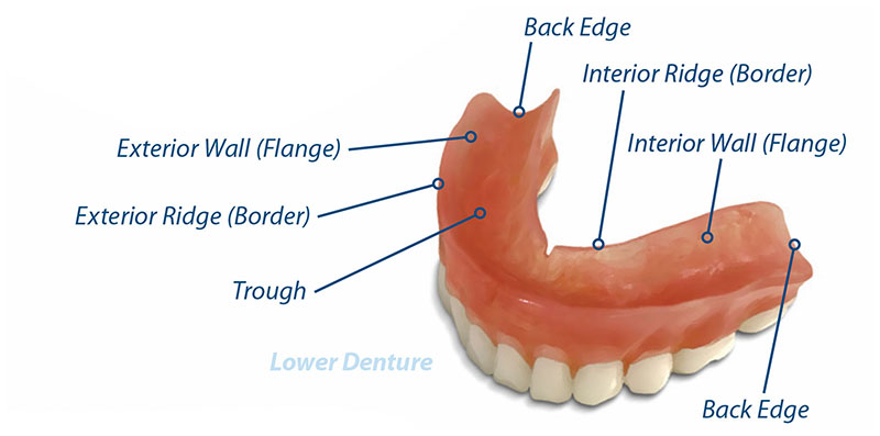 anatomy of a lower denture